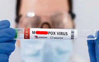 世界衛生組織28日宣佈“mpox”為猴痘的新名稱。（示意圖：互聯網）