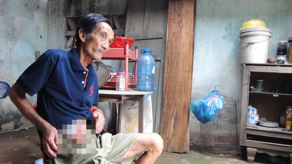 Ông Nguyễn Bảo Nhuận đang sống đơn độc trong căn nhà sắp sập, thân mang bệnh tật