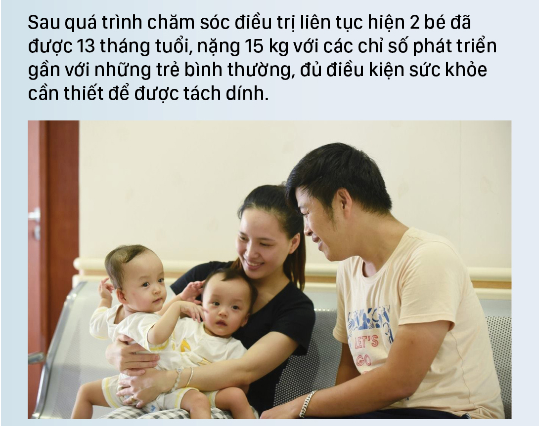 Hành trình của cặp song sinh dính liền hiếm gặp nhất Việt Nam Diệu Nhi - Trúc Nhi ảnh 4