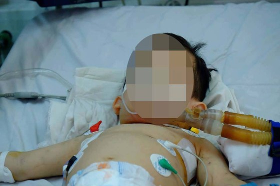 Bị chó cắn, hai trẻ nhập viện trong tình trạng nguy kịch ảnh 1