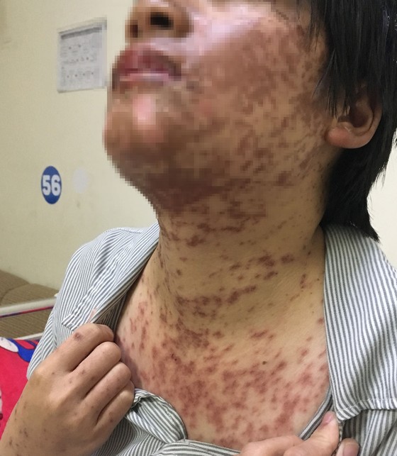 Nhập viện vì dùng thuốc tùy tiện ảnh 1