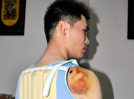 Khởi tố con trai bí thư đảng ủy xã dùng súng điện bắn người ảnh 1
