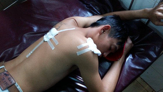 Công an xã bắn bị thương 3 thanh niên ảnh 1