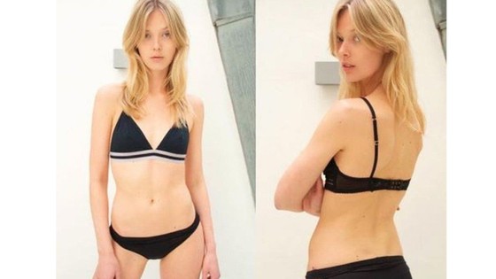 Christian Dior và Gucci "chê" người mẫu "mỏng" ảnh 1
