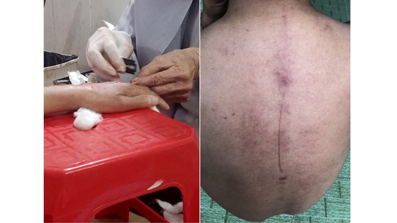 Loạn 'thần y'- Bài 1: Chữa bách bệnh bằng dao lam, nện và… chuối ảnh 2