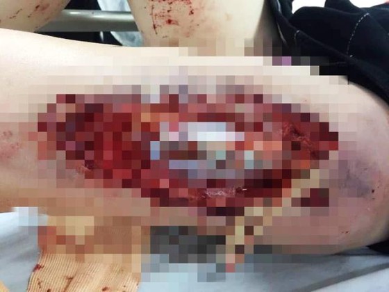 Chủ tịch TP Hà Nội: Không để xảy ra pháo sáng trên sân Hàng Đẫy và Mỹ Đình ảnh 3