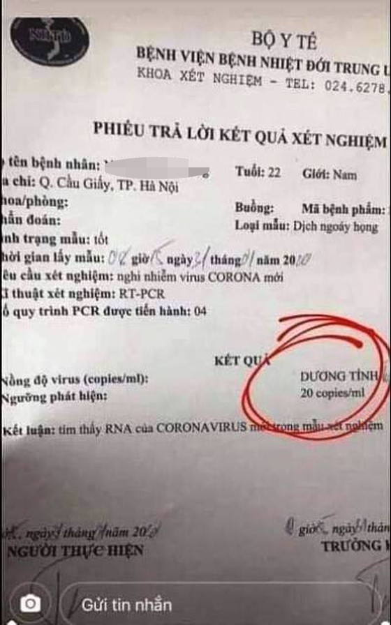 Cả gan làm giả kết quả xét nghiệm virus Corona ảnh 1