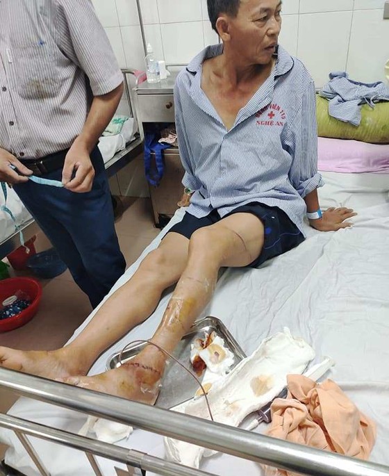 Bắt khẩn cấp đối tượng chém công an viên ảnh 1