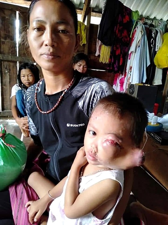 Hộ nghèo dân tộc Jrai có 3 con bệnh nặng ảnh 1