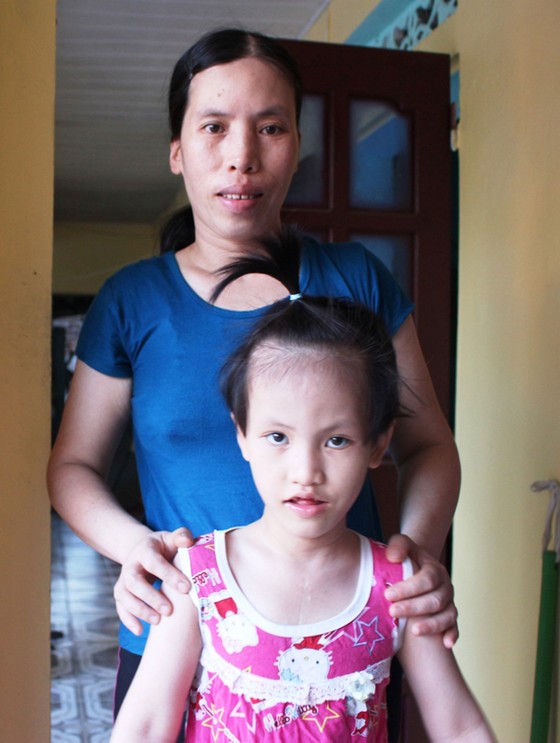 Con cần máy trợ thính ảnh 1