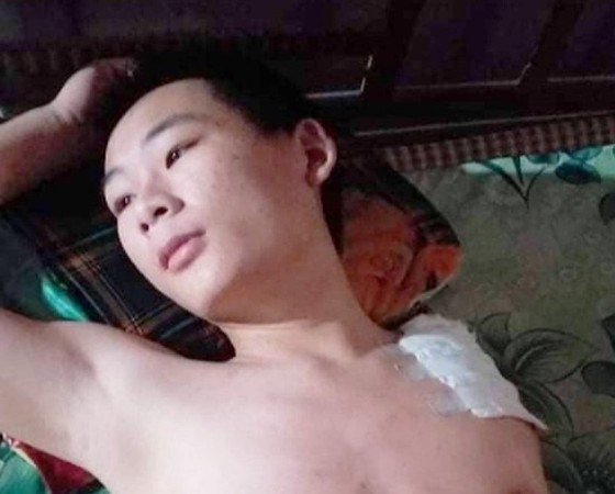 Lao động trẻ bị nạn, gia cảnh khốn khó ảnh 1