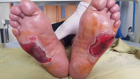 Biến chứng vì “Cặp đá kỳ diệu” ảnh 2