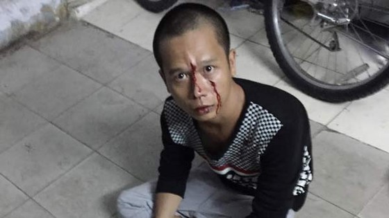 Cảnh sát giao thông bắt tên cướp giật điện thoại ảnh 1