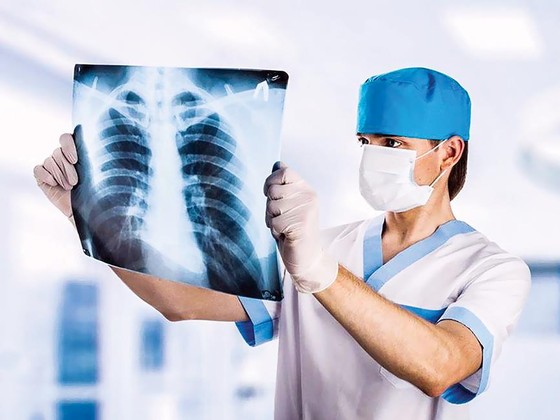 Điều trị hiệu quả ung thư phổi ảnh 2