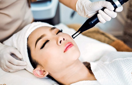 Trẻ hóa làn da bằng laser ảnh 2