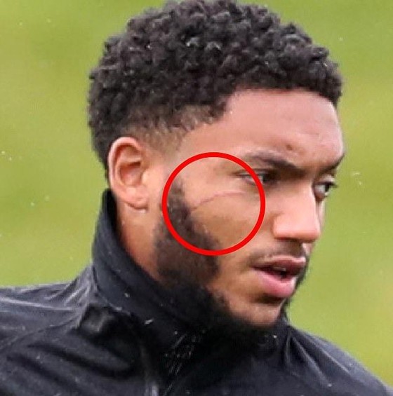 Tuyển Anh gạt Sterling khỏi đội hình vì đánh sưng mặt Joe Gomez ảnh 1