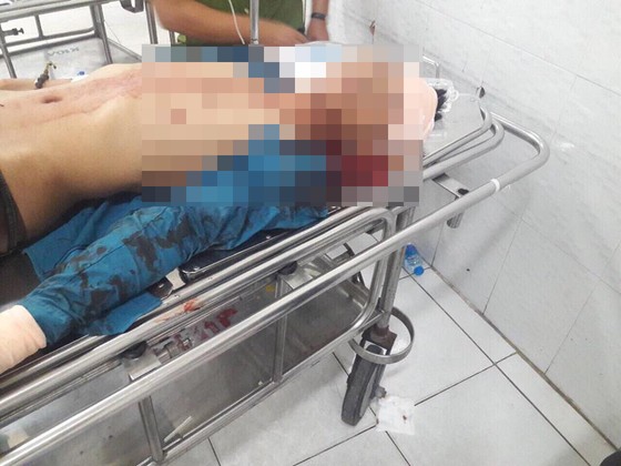 Bắt nhóm đối tượng truy sát nhầm người vì ghen tuông ảnh 2