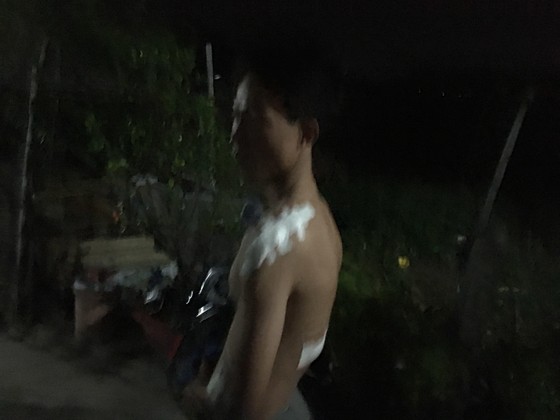 Công an khống chế kẻ chém hai vợ chồng cùng con nhỏ ở vùng ven ảnh 1