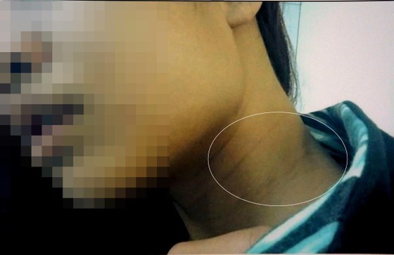Đề nghị truy tố anh rể hờ hiếp dâm du học sinh Mỹ ảnh 1