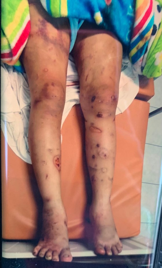 Khởi tố, bắt tạm giam kẻ bắt cóc, tra tấn thai phụ 18 tuổi đến sẩy thai ảnh 2