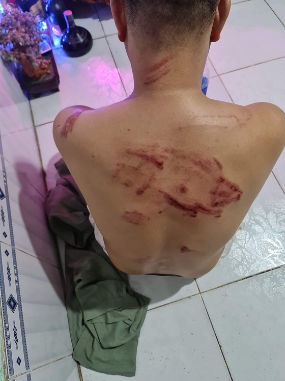 Nhóm 'giang hồ' dùng hung khí xông vào nhà dân đánh người ảnh 4