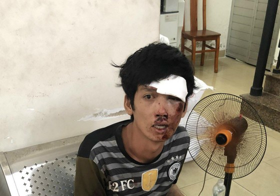 Bắt tên cướp đẩy người xuống kênh cướp tài sản ảnh 1