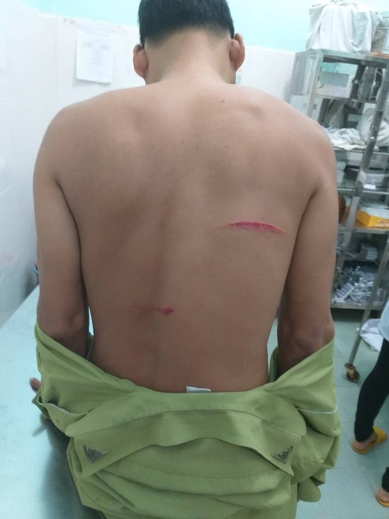 Xin gỗ không được, lâm tặc rượt chém kiểm lâm ảnh 2