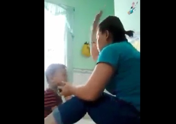 3 trẻ nhỏ ở An Giang bị bảo mẫu bạo hành ảnh 2