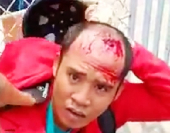 Chích điện chủ tiệm vàng, cướp tài sản giữa ban ngày ảnh 1