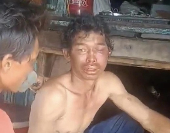 Công an tỉnh Cà Mau thông tin vụ 2 ngư dân bị hành hạ dã man trên tàu cá ảnh 2