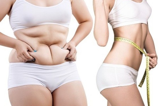 Giải pháp mới hiệu quả cho người thừa cân, béo phì ảnh 1