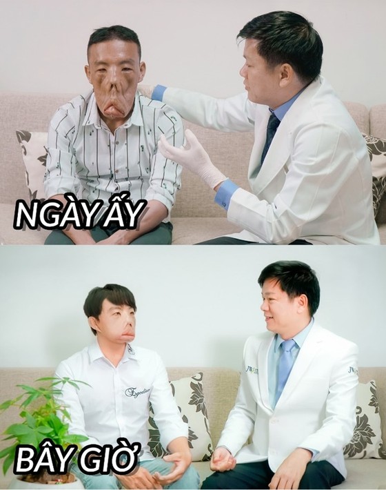 Bộ Y tế vinh danh bác sĩ Tú Dung điều trị thành công bệnh hiếm gây biến dạng mặt ảnh 1
