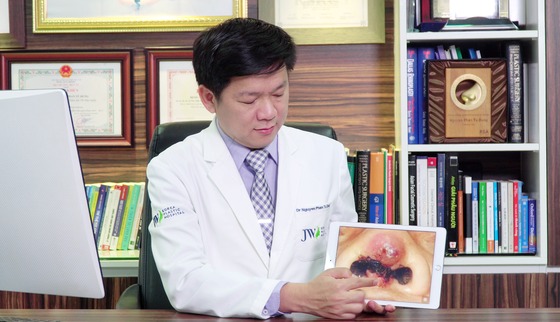 Một phụ nữ bị đứt lìa trụ mũi vì thẩm mỹ 'dạo' ảnh 1