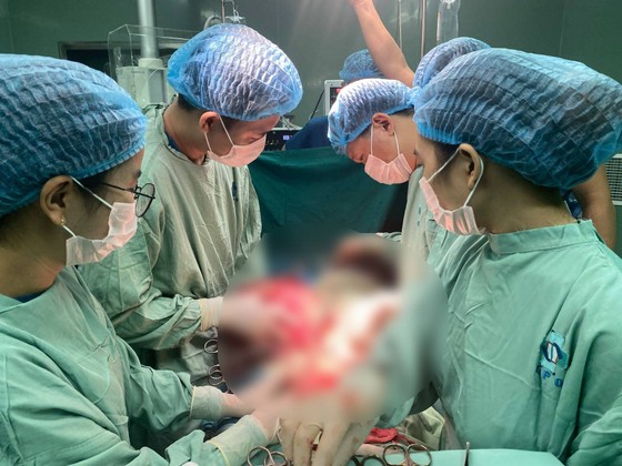 Phẫu thuật thành công khối u xơ nặng 5kg cho người phụ nữ 47 tuổi ảnh 1