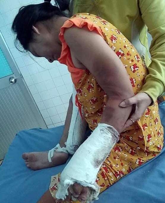 Khởi tố kẻ đánh gãy chân, tay thai phụ ảnh 1