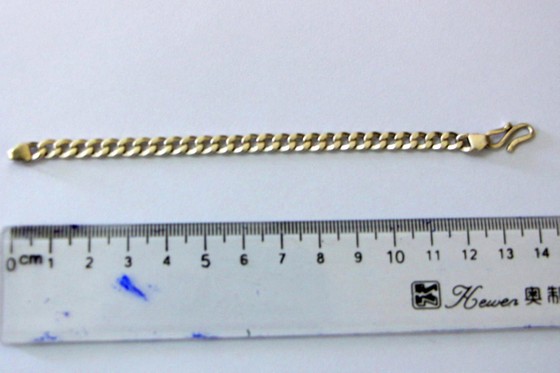 Gắp sợi dây chuyền bạc dài 14cm trong khí phế quản của bệnh nhi 28 tháng tuổi ảnh 2