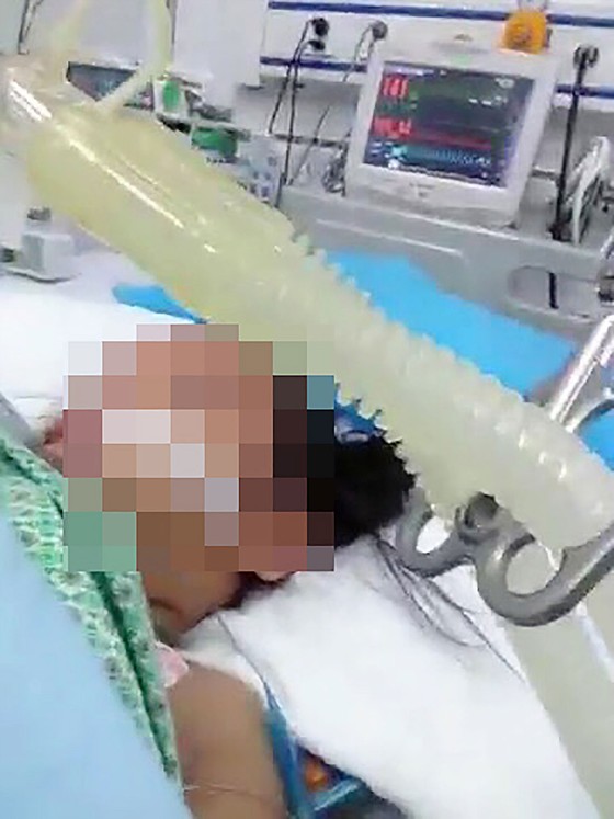 Tăng cường bảo vệ và chăm sóc trẻ em: Hãy lên tiếng khi trẻ em bị bạo hành ảnh 1