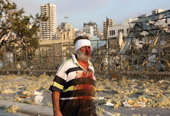 Nổ ở Beirut, hàng ngàn người thương vong ảnh 22