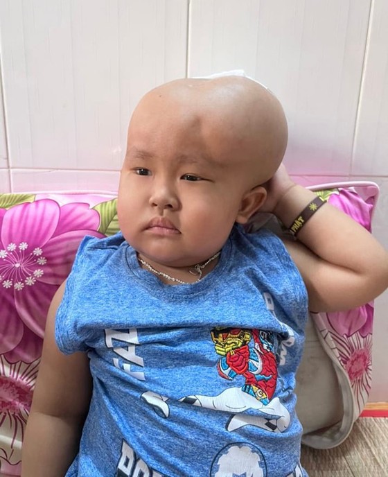 Bé trai bị u não ác tính ảnh 1