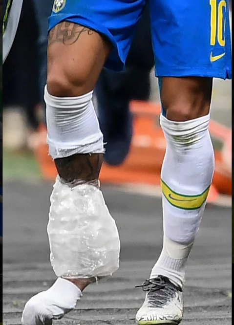 Dính chấn thương nặng, Neymar chia tay Copa America trong nước mắt ảnh 3
