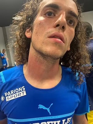 Bạo động trong trận Nice – Marseille, CĐV tràn vào sân tấn công Dimitri Payet, trọng tài phải hủy trận đấu ảnh 4