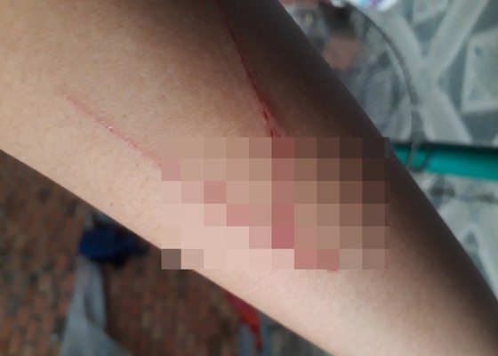 Sự thật bé gái bị hiếp dâm, sau đó lại bị chém vào tay ảnh 1