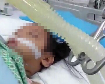 Bé gái 3 tuổi bị người tình của mẹ đóng 9 chiếc đinh vào đầu đã tử vong ảnh 1