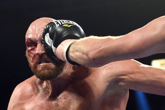 Quyền Anh: Fury “giận dữ” trả giá cho chiến thắng - rách chân mày, máu chảy đầy mặt phải nhập viện ảnh 4