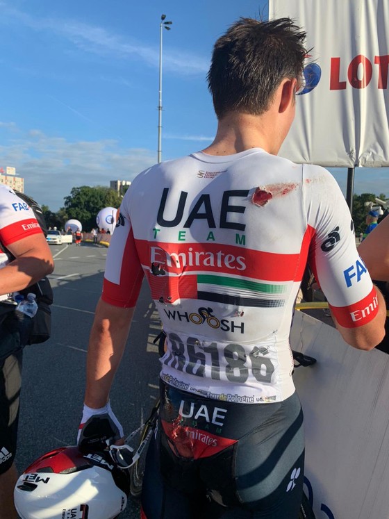 Tour de Pologne: Đua nước rút ở đích đến, Fabio Jakobsen gặp tai nạn thảm khốc, phải mổ não ảnh 2