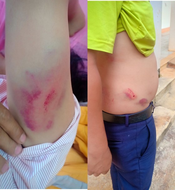 Đắk Nông: Làm rõ vụ việc Chánh Văn phòng đánh lái xe nhập viện ảnh 1