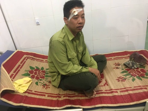 Vận chuyển gỗ lậu rồi đánh lực lượng kiểm lâm trọng thương ảnh 2
