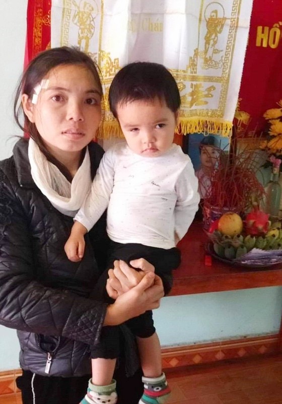 Bé gái 2 tuổi mong được cứu đôi mắt ảnh 1