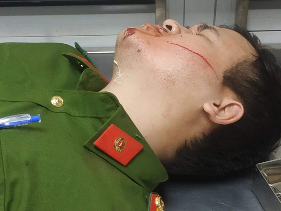 Hai chiến sĩ công an bị thương khi ngăn đối tượng bị bệnh tâm thần đe dọa giết người ảnh 2