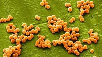 Bacterium Staphylococcus causes 42 percent of food poisoning